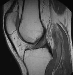 Winelands Radiology | Musculoskeletal Imaging Update